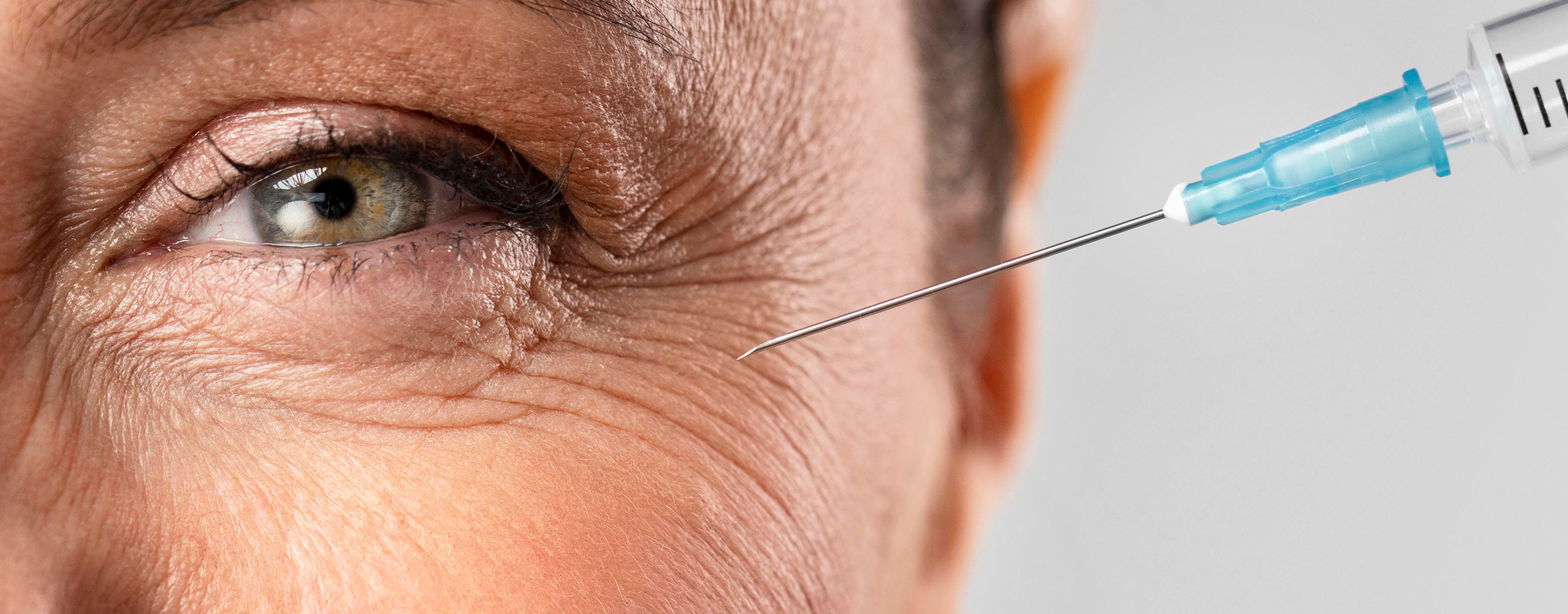 Fillers faciales – Rellena, armoniza y rejuvenece sin cirugía