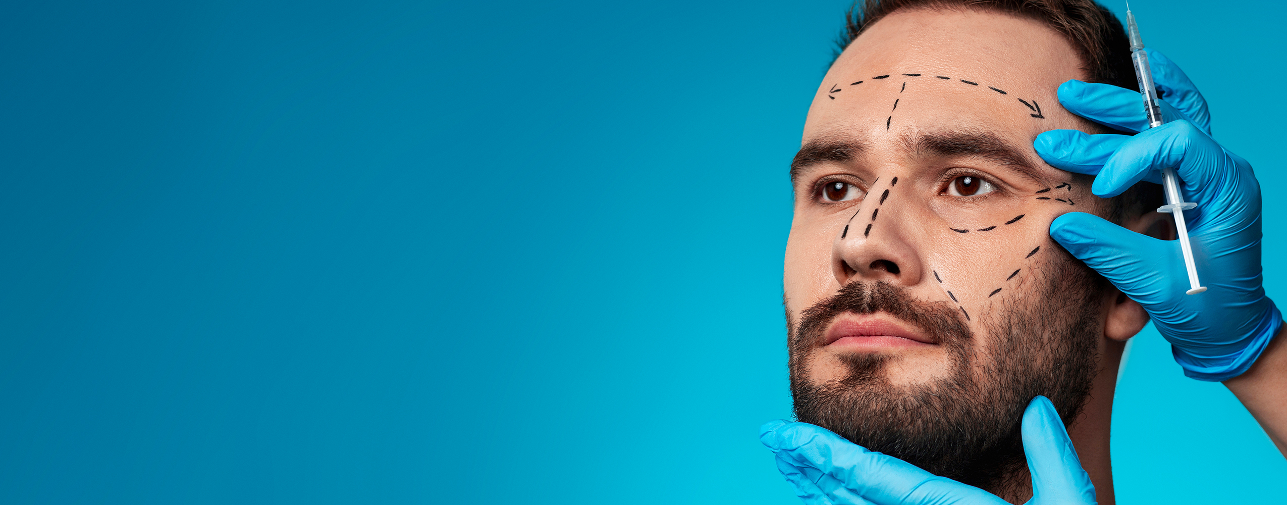 Rinoplastia – Armonía facial y confianza en una sola intervención